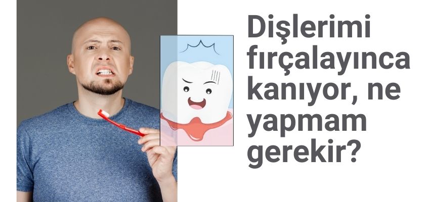 Diş Fırçalarken Diş Eti Kanaması