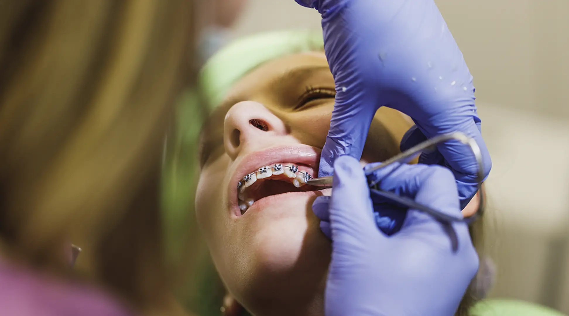 orthodontics-dental-braces